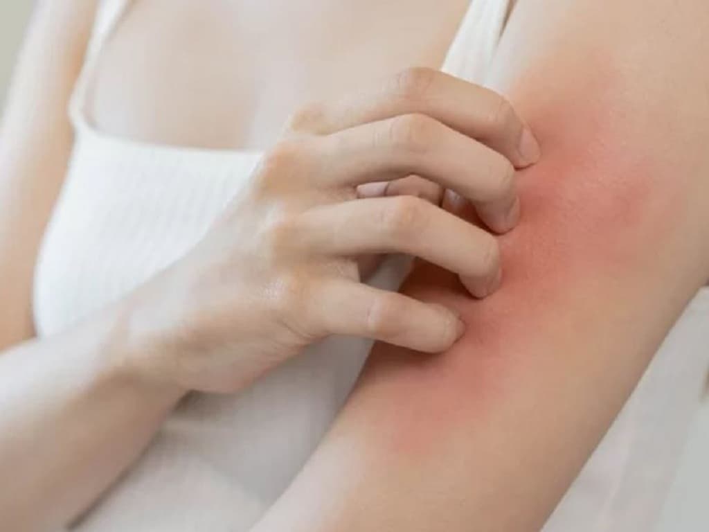 Nguyên nhân và cách điều trị ngứa da ở người bệnh gan