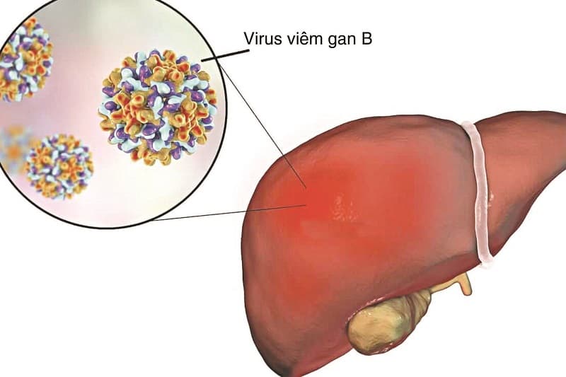 Tại sao men gan "ALT,AST" vẫn tăng sau khi dùng thuốc kháng virus?