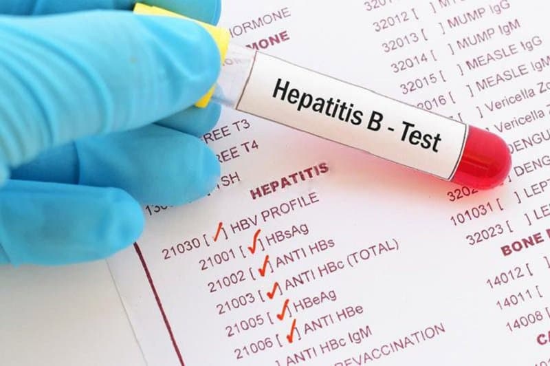 Bệnh nhân Ung thư gan do HBV lần đầu tiên khỏi viêm gan B lâm sàng tại Việt Nam
