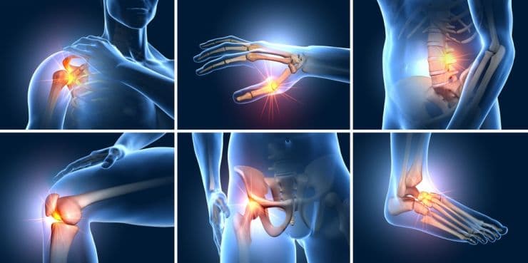 Bệnh nhân bệnh gan kết hợp loãng xương, tìm hiểu về bệnh xương gan