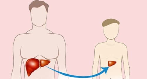 Đọc bài viết này | 4 câu hỏi thường gặp về ung thư gan tái phát sau ghép gan, bạn muốn hỏi gì đều có ở đây