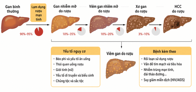 Bệnh gan do rượu: đừng chờ vàng da mới đi khám