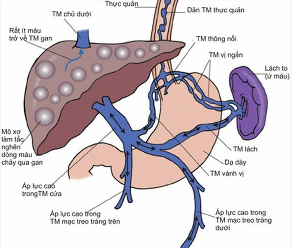 Hệ Tĩnh Mạch Cửa: Tìm Hiểu, Chẩn Đoán và Điều Trị